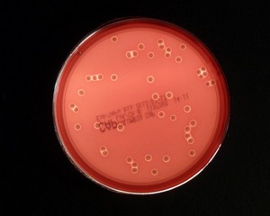 plate with colonies of staphylococcus aureus, beta-hemolysis